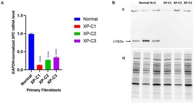 Xeroderma Pigmentosum C (XPC) Mutations in Primary Fibroblasts Impair Base Excision Repair Pathway and Increase Oxidative DNA Damage